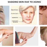 how to lift saggy skin -idealift